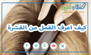 كيف اعرف القمل من القشرة