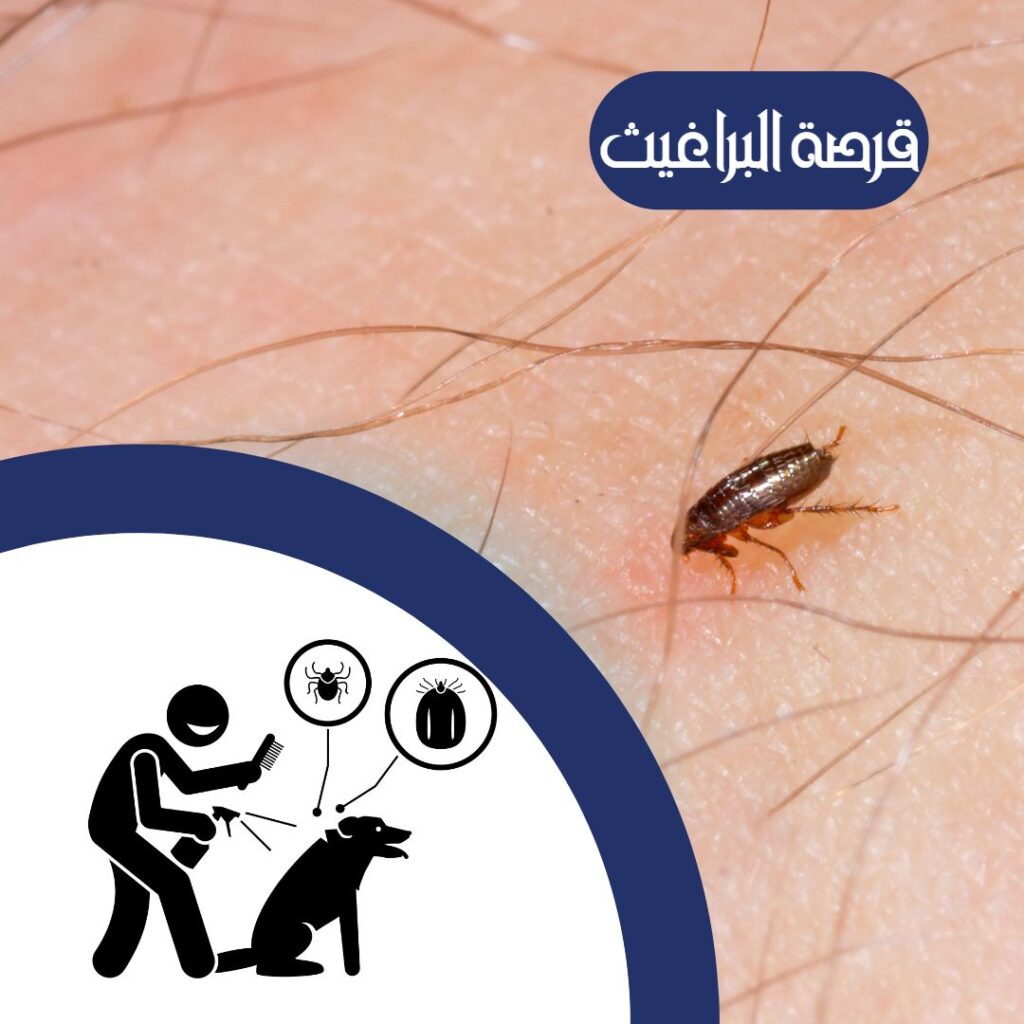 علاج لدغة البرغوث