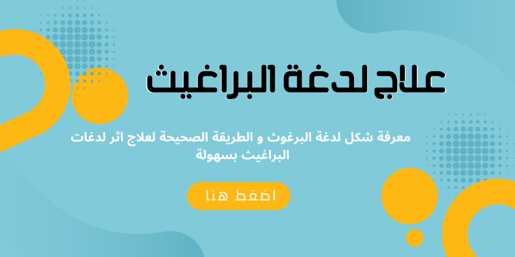 علاج لدغة البراغيث